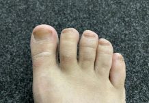 IMATE LI GLJIVICE I ŽUTE, ZADEBLJALE NOKTE: Samo namažite ovo ulje i riješit ćete problem preko noći IMATE LI GLJIVICE I ŽUTE, ZADEBLJALE NOKTE: Samo namažite ovo ulje i riješit ćete problem preko noći - featured image