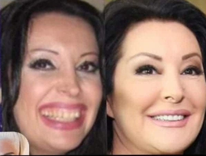 KAD SU SKUPILI PARE, URADILI SU ZUBE: POGLEDAJTE kako su izgledale domaće ličnosti PRIJE UMJETNIH ZUBA – CECA JE HIT (FOTO) - featured image