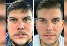 Što se događa vašem tijelu kada ne pijete alkohol 28 dana? Što se događa vašem tijelu kada ne pijete alkohol 28 dana? - featured image