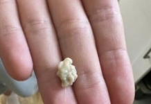 “Neočekivano i šokantno iskustvo: Ono što je izašlo iz mog grla će vas ostaviti bez riječi 😳”