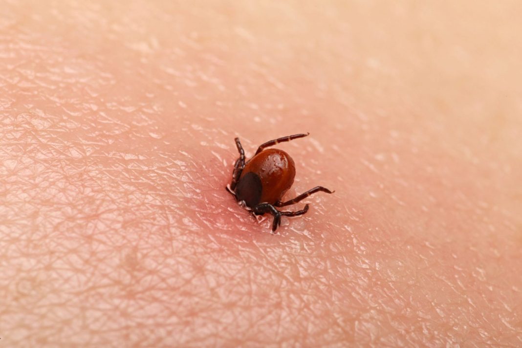 Bezbolno je i nema čupanja: Doktorka otkrila trik kako da se krpelj sam otkači sa kože (video) - featured image