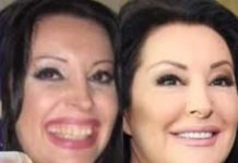 POGLEDAJTE kako su izgledale domaće ličnosti PRIJE UMJETNIH ZUBA – CECA JE HIT (FOTO) POGLEDAJTE kako su izgledale domaće ličnosti PRIJE UMJETNIH ZUBA – CECA JE HIT (FOTO) - featured image