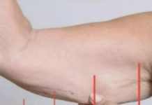 EVO ZAŠTO IMATE NEOBIČNO OBJEŠENU KOŽU- Većina ljudi nema pojma o ovom problemu. Jedino efikasno rješenje je ovaj domaći trik EVO ZAŠTO IMATE NEOBIČNO OBJEŠENU KOŽU- Većina ljudi nema pojma o ovom problemu. Jedino efikasno rješenje je ovaj domaći trik - featured image